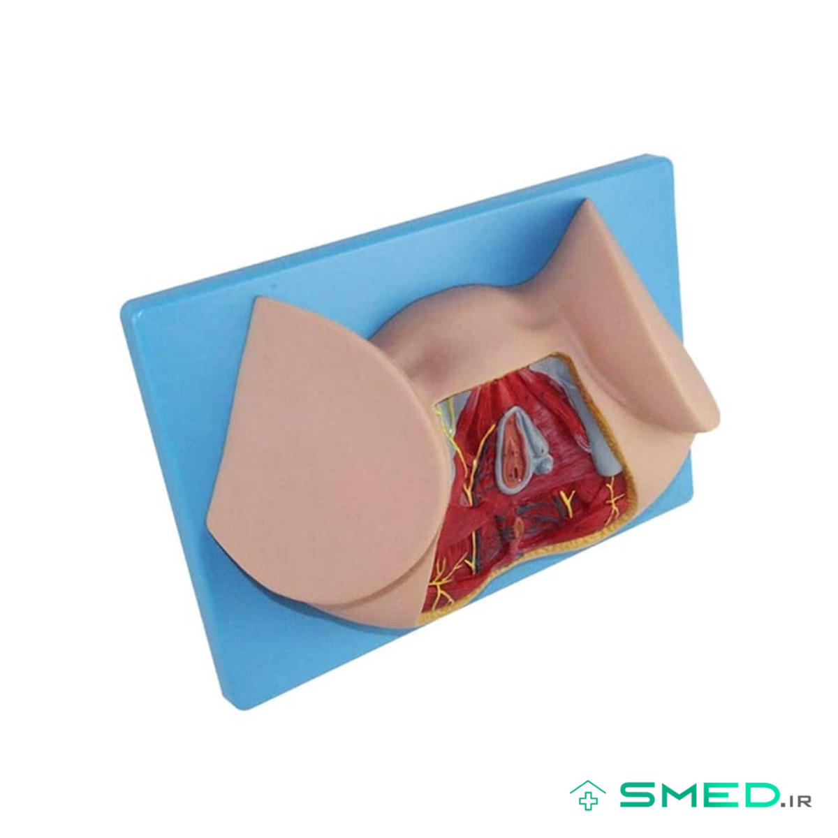مولاژ ناحیه پرینه زن