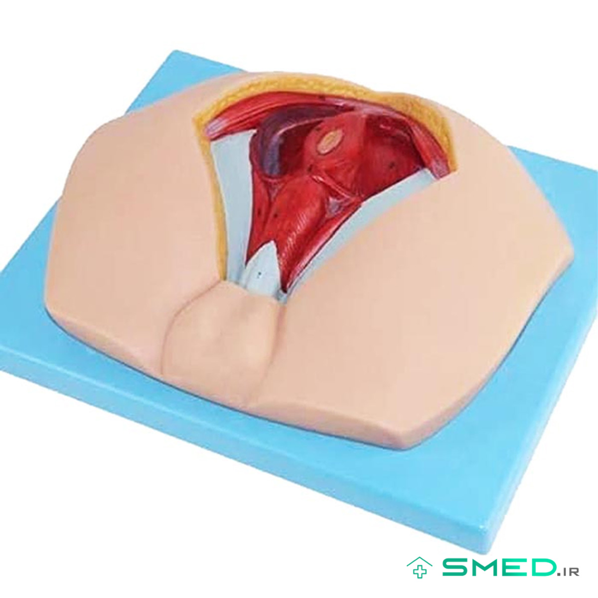 مولاژ ناحیه پرینه زن