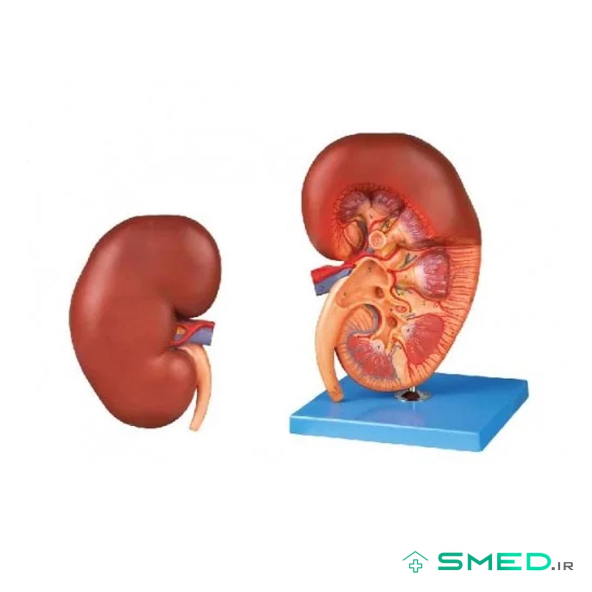 مولاژ کلیه و غده فوق کلیوی