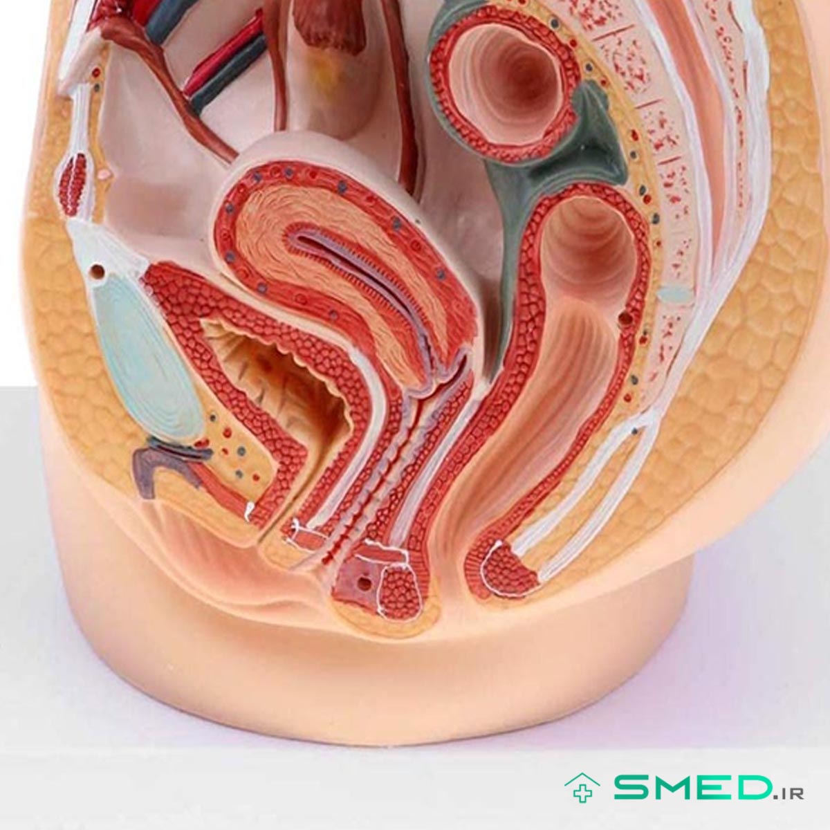 مولاژ ساژینال عضلات لگن زنانه و مردانه