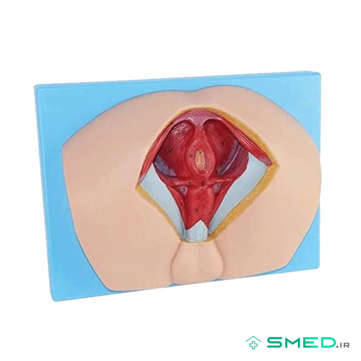 مولاژ ناحیه پرینه زن