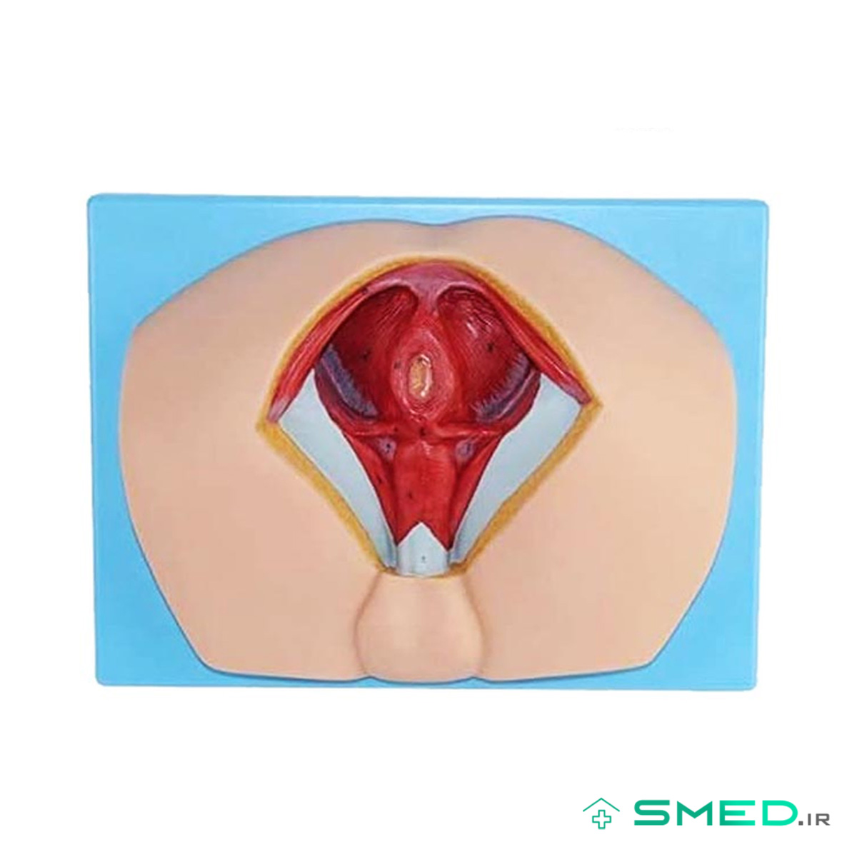 مولاژ ناحیه پرینه زن