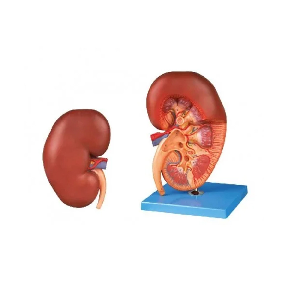 مولاژ کلیه